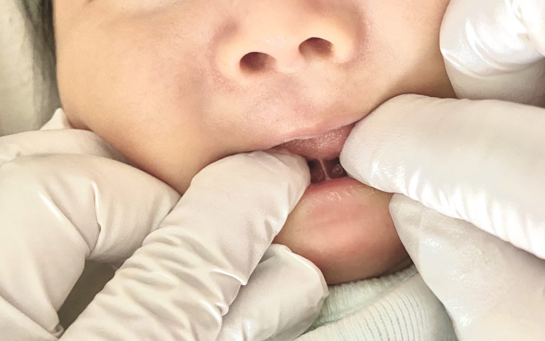 Closeup of two fingers in white gloves opening a baby's mouth